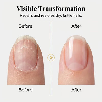 3 Days Nail Care, Keratin Amino Acid Nail Care, Strengthening and Hydration, for Dry, Weak & Fragile Nails