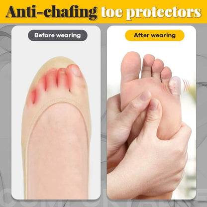 🔥Silicone anti-friction toe protector
