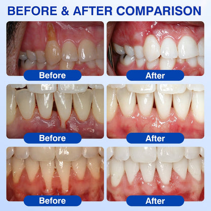 🏅🦷🛡️Evolvion® GumRevive Periodontal Repair Gel