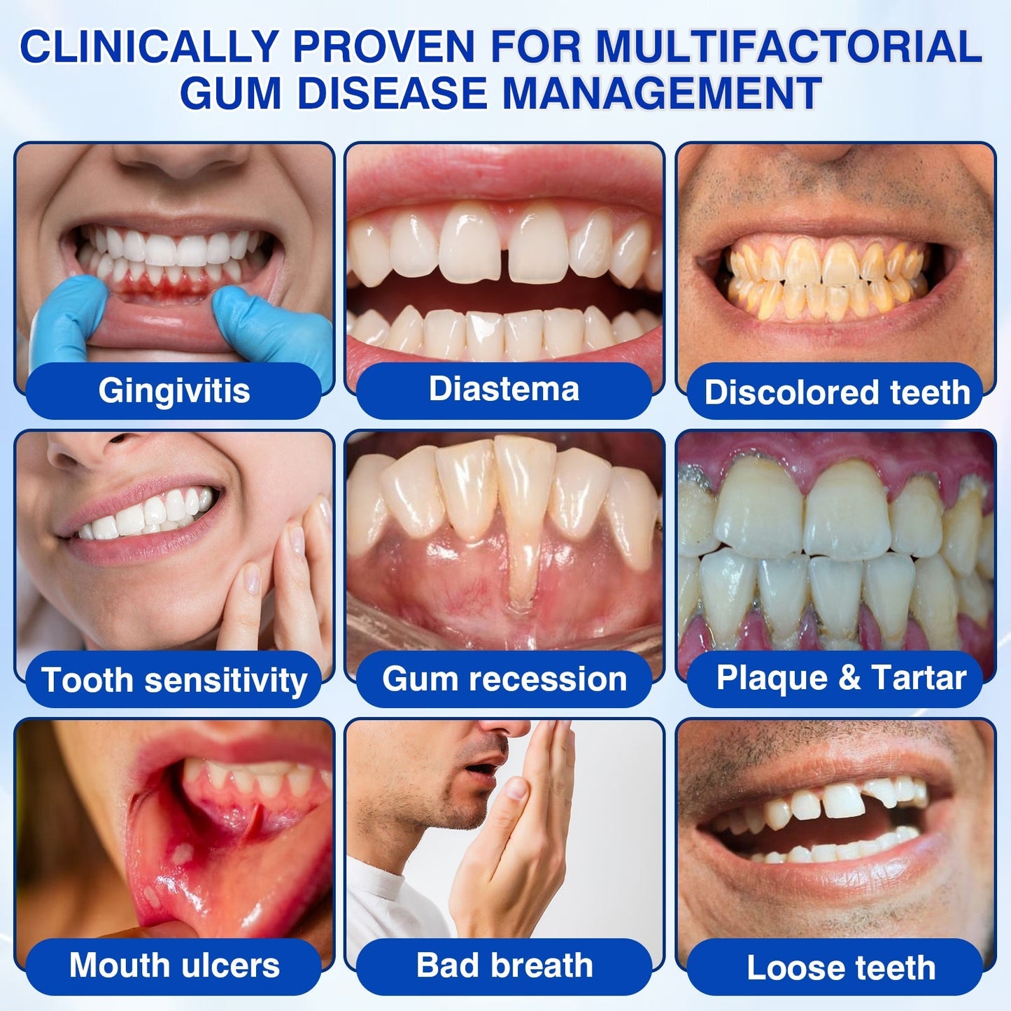 🏅🦷🛡️Evolvion® GumRevive Periodontal Repair Gel