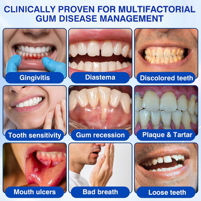 🏅🦷🛡️Evolvion® GumRevive Periodontal Repair Gel