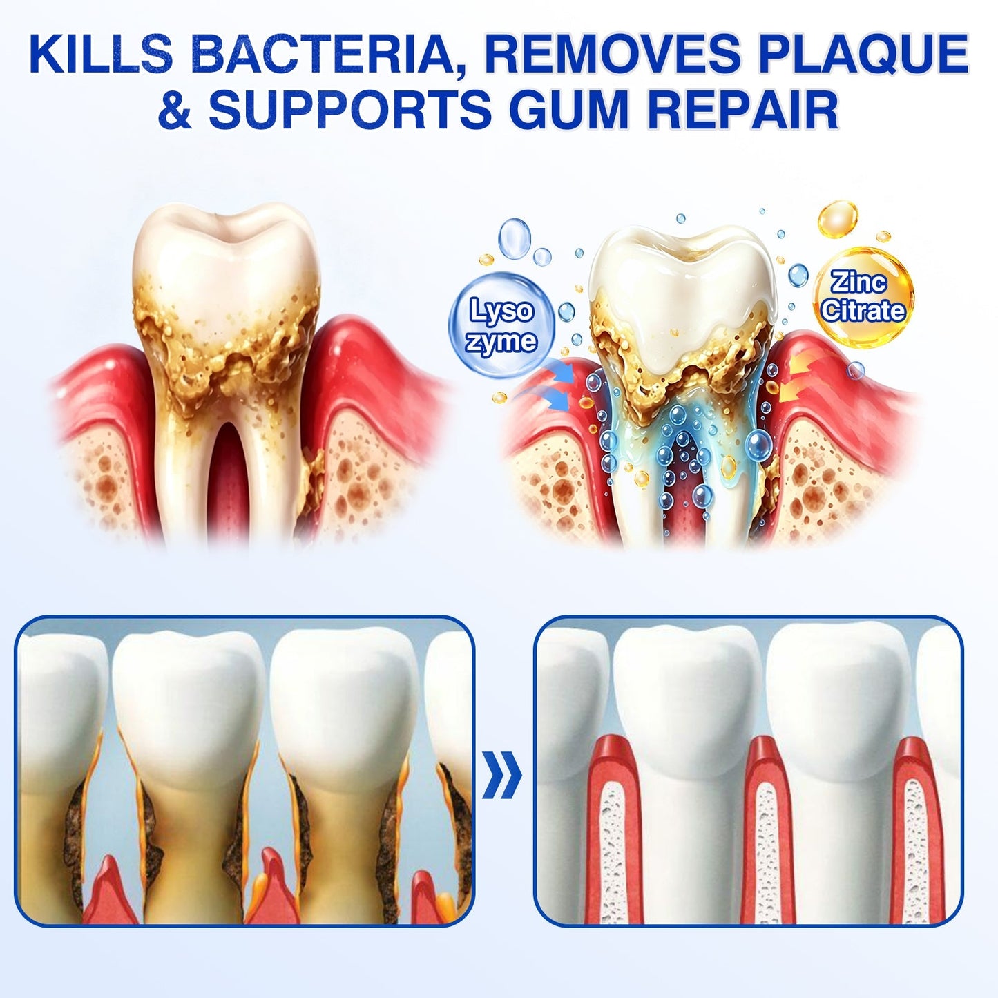 🏅🦷🛡️Evolvion® GumRevive Periodontal Repair Gel
