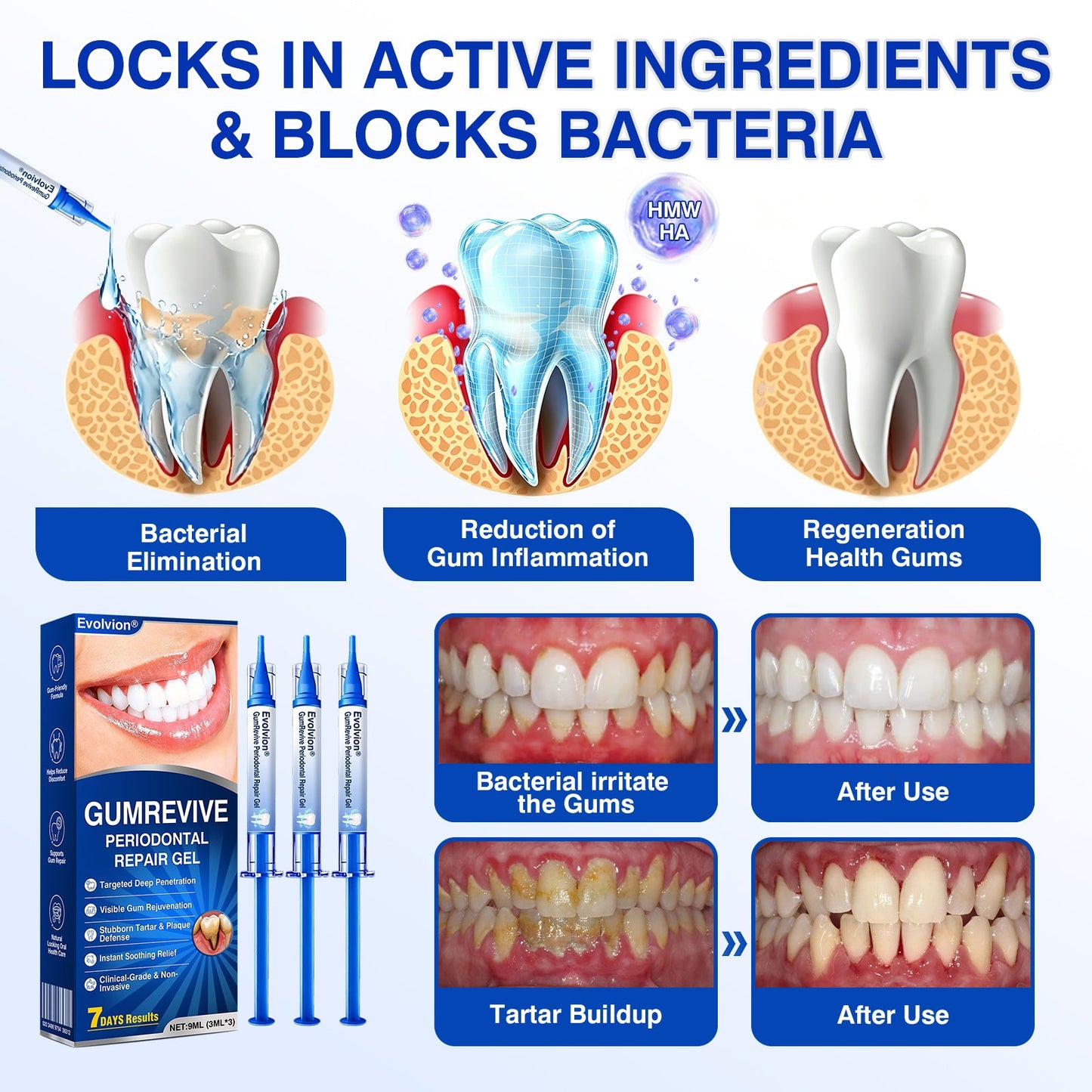 🏅🦷🛡️Evolvion® GumRevive Periodontal Repair Gel
