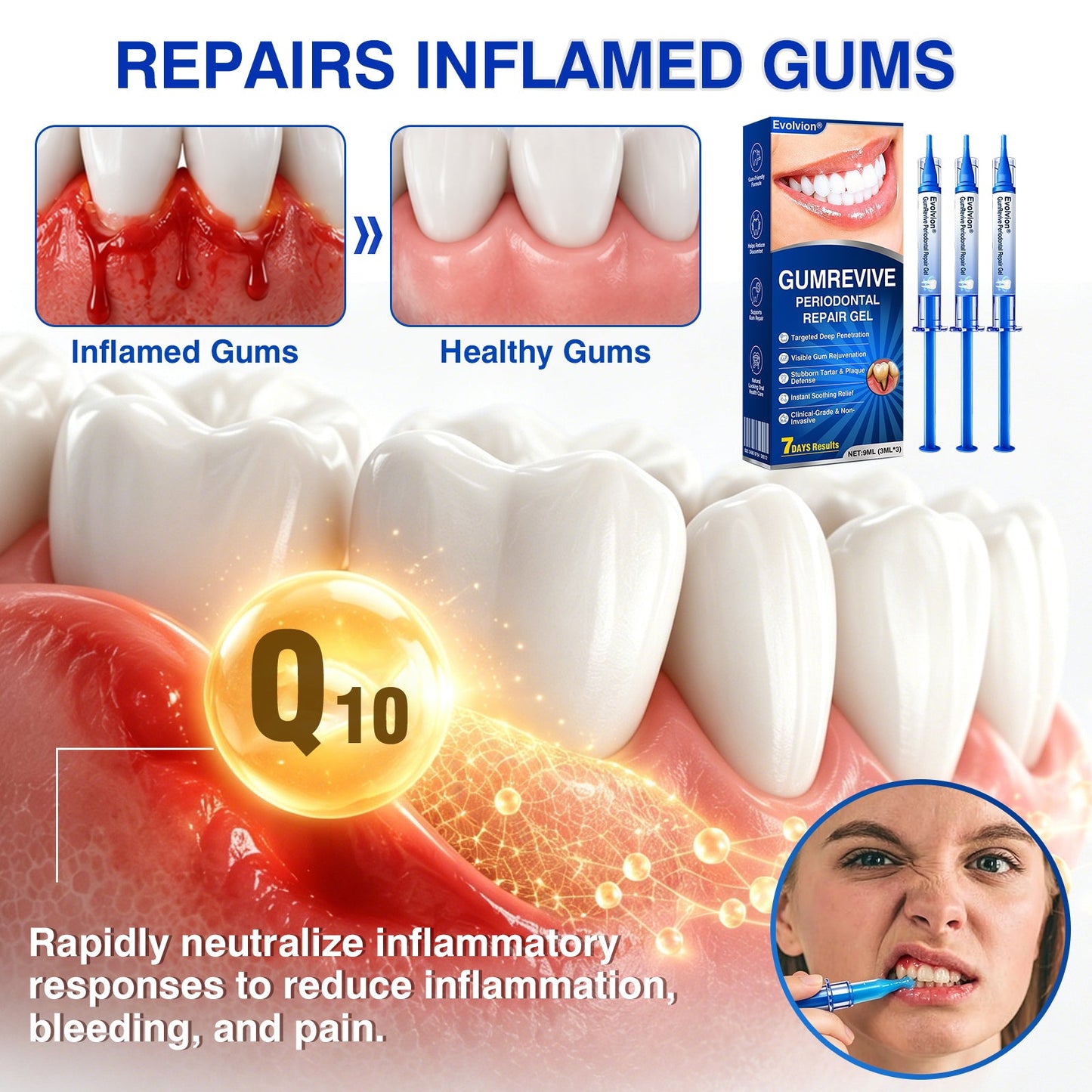 🏅🦷🛡️Evolvion® GumRevive Periodontal Repair Gel