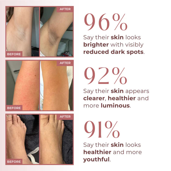 Dr. Melaxin PEEL SHOT 99% Kojic Acid + Turmeric Body Exfoliating Spray
