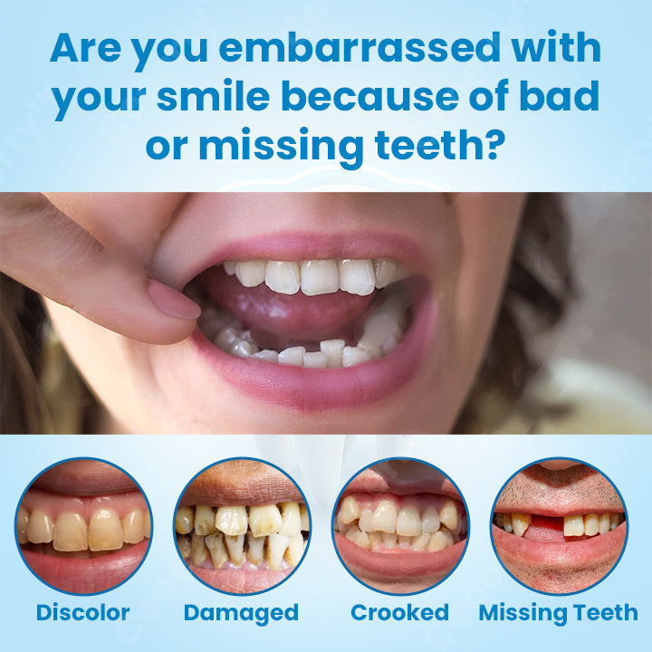 Full-coverage dental veneers / Cosmetic dental aligners