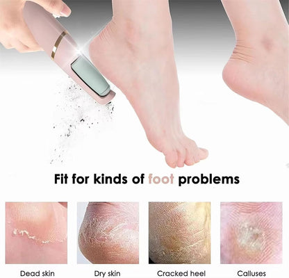 Electric Foot File – Rechargeable Callus Remover for Hard, Cracked Skin – at-Home Pedicure Kit for Smooth Feet (Men & Women) (Pink)