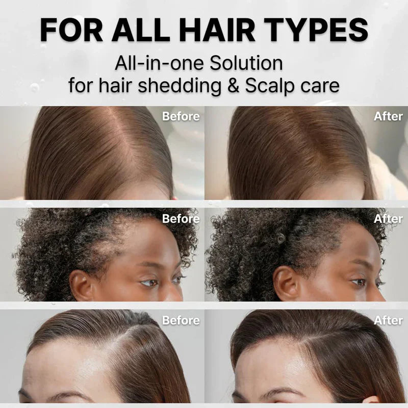 38-Bristle Hair Growth Scalp Serum