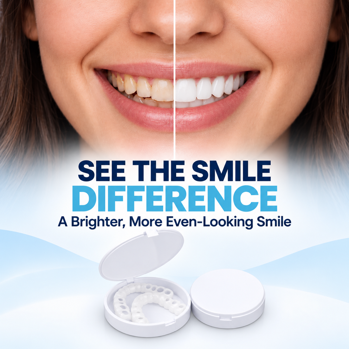 🔥LAST DAY SALE 49% OFF!!⚡50K+ SOLD!❄️✨ Instant Snap-On Smile Veneers – A Confident Smile in Seconds! 😁