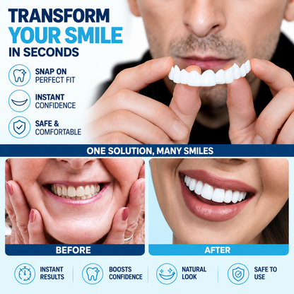 🔥LAST DAY SALE 49% OFF!!⚡50K+ SOLD!❄️✨ Instant Snap-On Smile Veneers – A Confident Smile in Seconds! 😁
