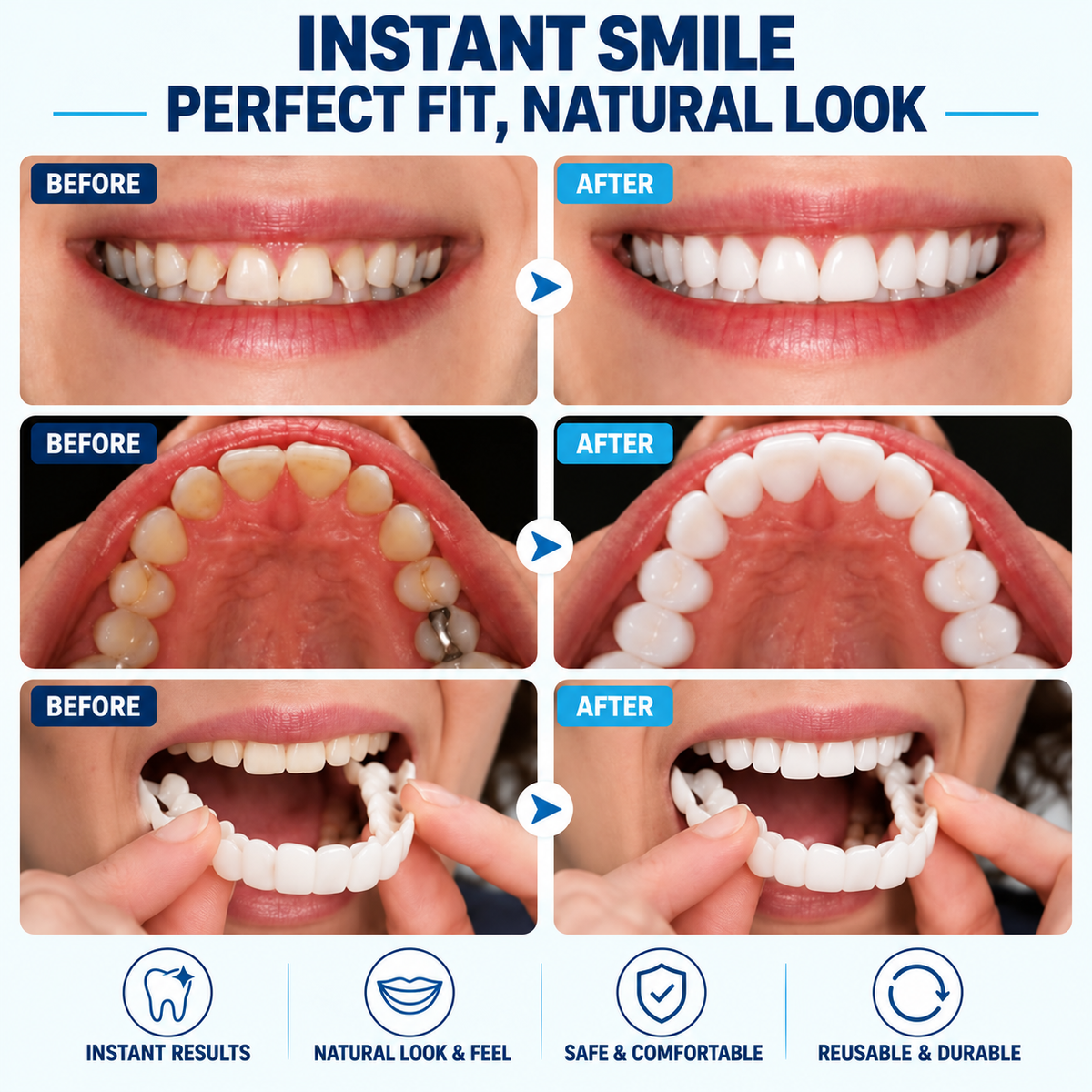 🔥LAST DAY SALE 49% OFF!!⚡50K+ SOLD!❄️✨ Instant Snap-On Smile Veneers – A Confident Smile in Seconds! 😁