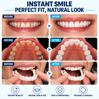 🔥LAST DAY SALE 49% OFF!!⚡50K+ SOLD!❄️✨ Instant Snap-On Smile Veneers – A Confident Smile in Seconds! 😁
