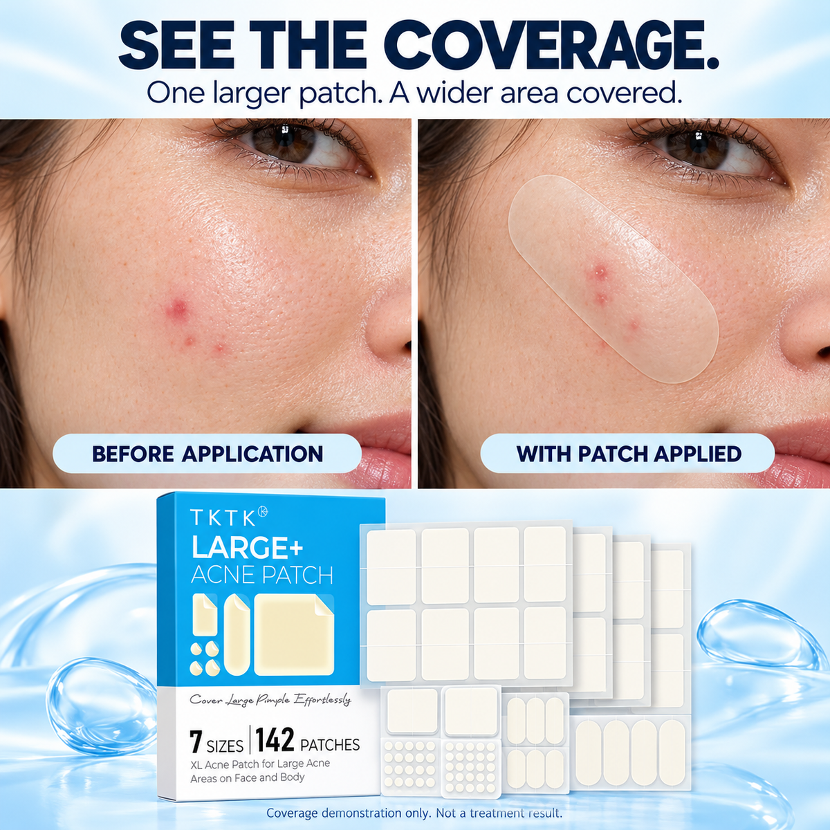 ✨ Hydrocolloid Pimple Patch Kit – 312/609 Patches, 7 Sizes for Small & Large Areas