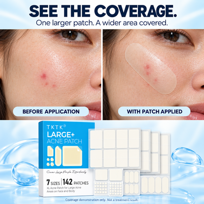 ✨ Hydrocolloid Pimple Patch Kit – 312/609 Patches, 7 Sizes for Small & Large Areas