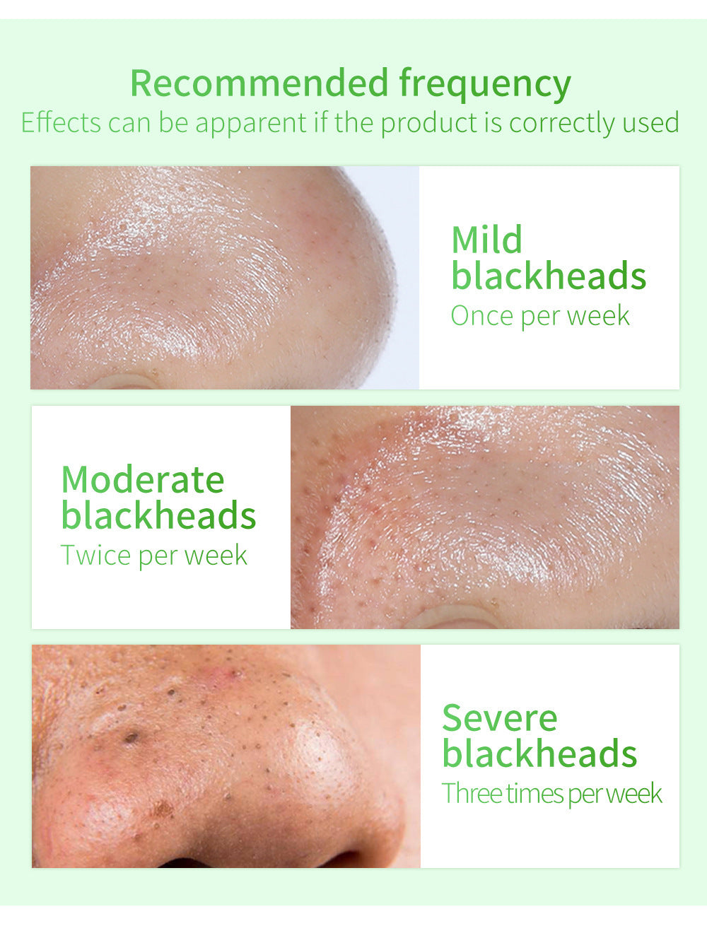🌿 50% OFF Green Tea Blackhead Remover Kit ✨ 100 Pore Strips + Pore Care Serum