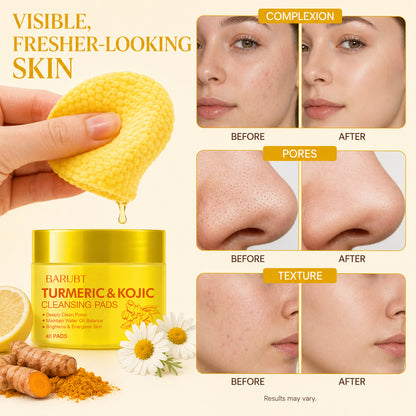 ✨ 50% OFF Turmeric Kojic Acid Cleansing Pads 🌿 Deep Clean Makeup Remover Pads For Brighter Skin