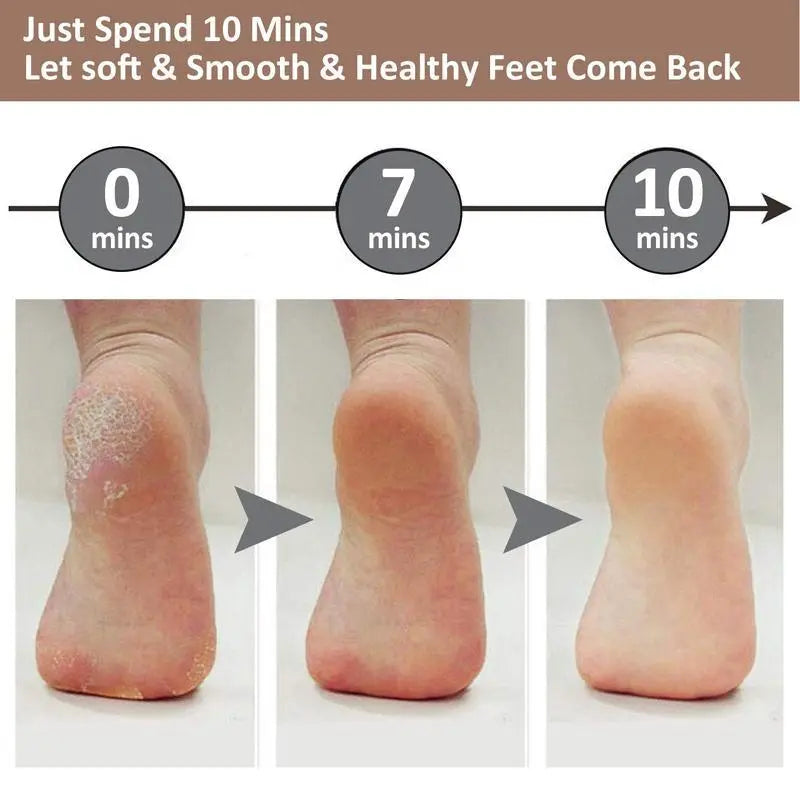 Electric Foot File – Rechargeable Callus Remover for Hard, Cracked Skin – at-Home Pedicure Kit for Smooth Feet (Men & Women) (Pink)