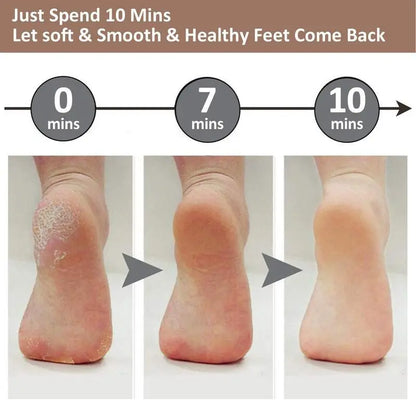 Electric Foot File – Rechargeable Callus Remover for Hard, Cracked Skin – at-Home Pedicure Kit for Smooth Feet (Men & Women) (Pink)