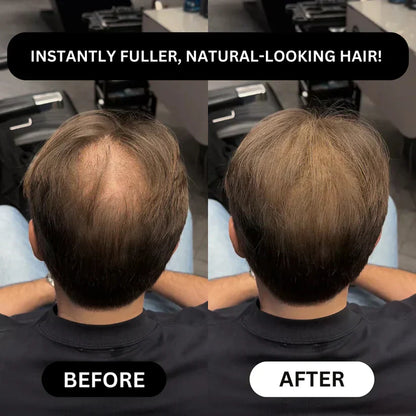 🔥Instant Hairline & Bald Spot Powder-Thicker-Looking Hair in 30 Seconds.For men & women with thinning hairline, part, or crown. Confidence All Day.