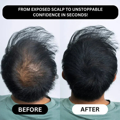 🔥Instant Hairline & Bald Spot Powder-Thicker-Looking Hair in 30 Seconds.For men & women with thinning hairline, part, or crown. Confidence All Day.
