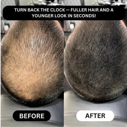 🔥Instant Hairline & Bald Spot Powder-Thicker-Looking Hair in 30 Seconds.For men & women with thinning hairline, part, or crown. Confidence All Day.
