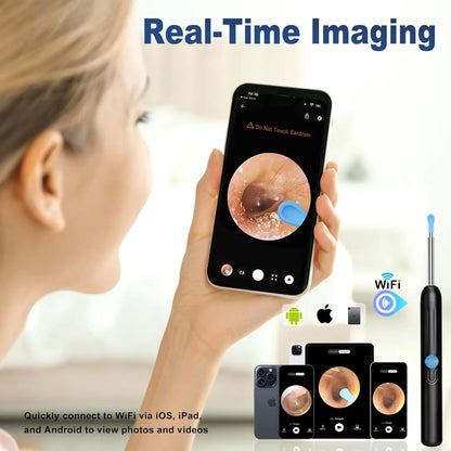 HD Visual Earwax Removal Tool with Camera - 1080P Ear Cleaner