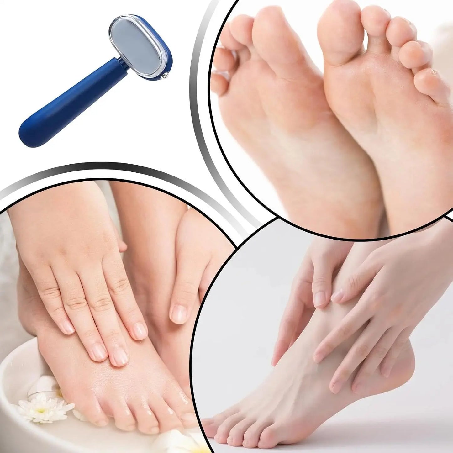 Buy 1 Get 1 Free🦶 Smooth Heels Fast ✨ Dual-Sided Foot Callus Remover with Replaceable Stainless Steel Blade