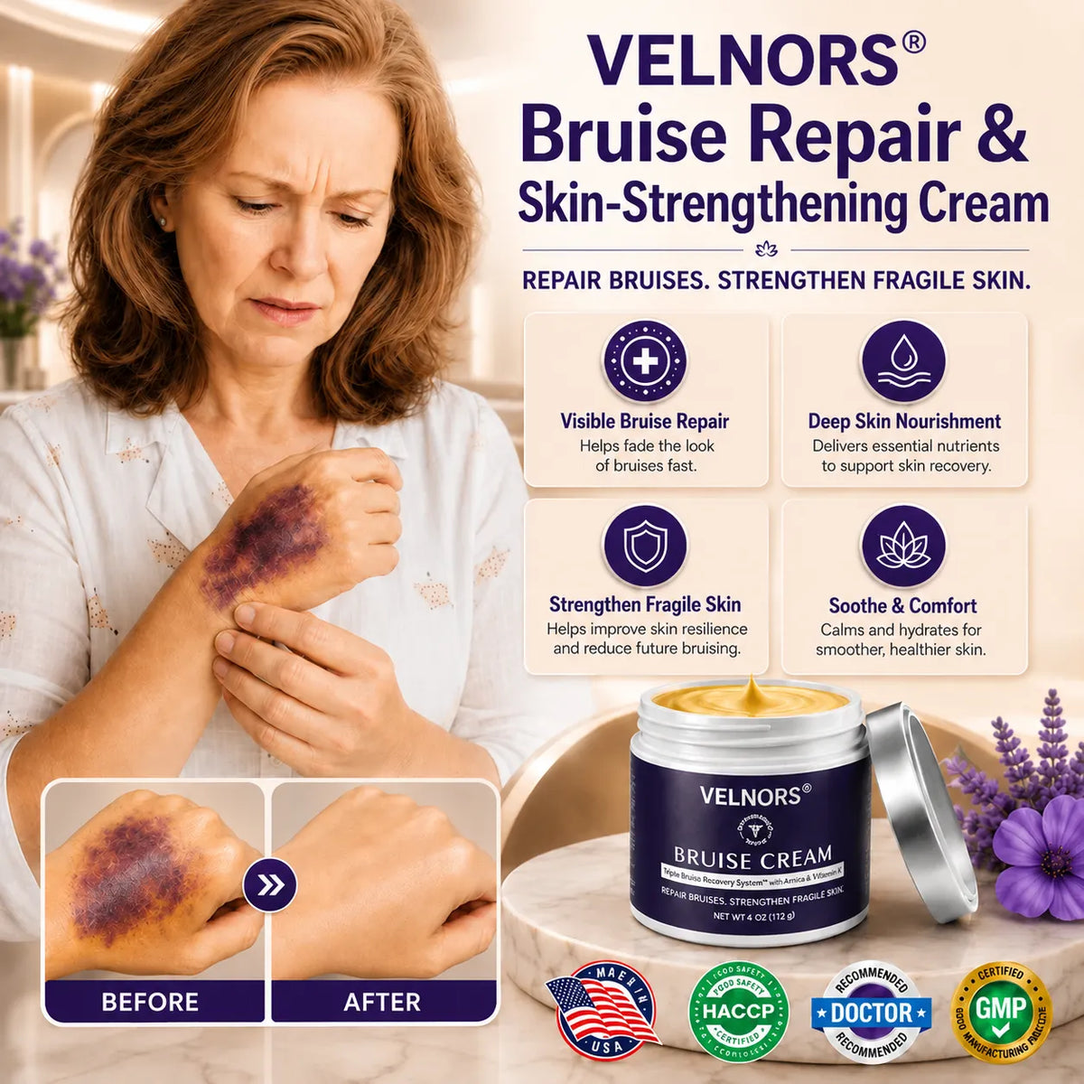 💥100K+ SOLD💕- VELNORS® Bruise Repair & Skin-Strengthening Cream