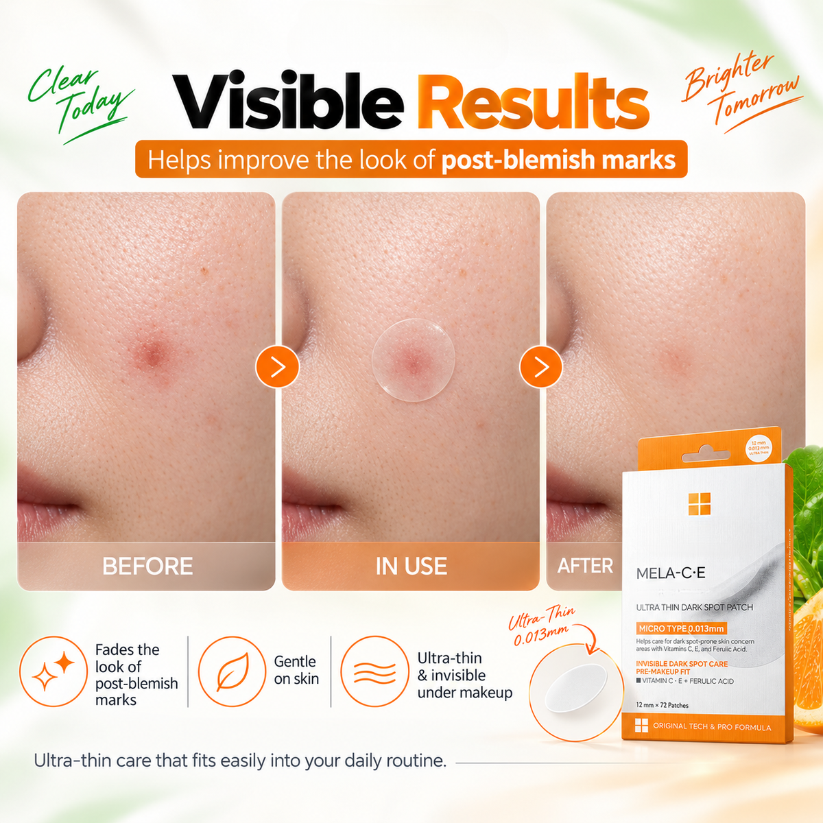 ✨Acne & Dark Spot Patch Duo – S-ZINC + Vitamin C, 72-Patch Twin Pack