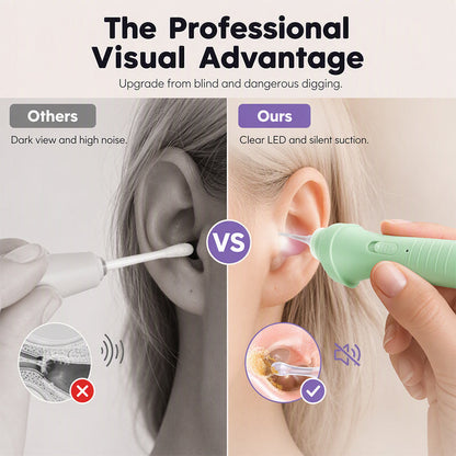 👂 LED Ear Wax Vacuum Cleaner with 65 kPa Suction & Washable Silicone Tips