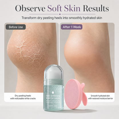 Moisturizing Roll-On Heel Care Cream